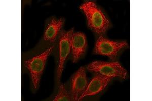 IF analysis of SBDS using anti-SBDS antibody (ABIN7600404) and anti-Beta Tubulin antibody (ABIN7602743). (SBDS antibody  (AA 19-241))