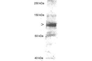 Western blot analysis of MLXIPL in 20 ug of human hepatocyte lysate using MLXIPL polyclonal antibody . (MLXIPL antibody  (AA 800-852))