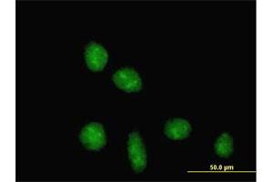 Immunofluorescence of purified MaxPab antibody to TRIM28 on HeLa cell. (KAP1 antibody  (AA 1-835))
