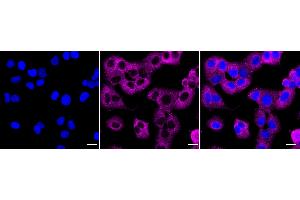 anti-DCP1 Decapping Enzyme Homolog A (S. Cerevisiae) (DCP1A) antibody