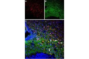 Multiplex staining of OX1R and Parathyroid hormone 1 receptor in rat ventromedial hypothalamus - Immunohistochemical staining of perfusion-fixed frozen rat brain sections using Anti-Orexin Receptor 1-ATTO Fluor-488 Antibody (ABIN7043286), (1:60) and Anti-PTH1R (extracellular) Antibody (ABIN7043429, ABIN7045112 and ABIN7045113), (1:60).