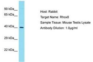 Image no. 1 for anti-Reproductive Homeobox 8 (RHOX8) (N-Term) antibody (ABIN6750248) (RHOX8 antibody  (N-Term))