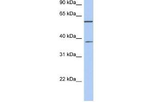 NUP43 antibody used at 1 ug/ml to detect target protein. (NUP43 antibody  (Middle Region))