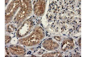 Immunohistochemical staining of paraffin-embedded Human Kidney tissue using anti-CAT mouse monoclonal antibody. (Catalase antibody)