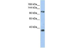 WB Suggested Anti-ZEB2 Antibody Titration:  0. (ZEB2 antibody  (N-Term))
