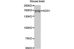 Western Blotting (WB) image for anti-Nitric Oxide Synthase 1, Neuronal (NOS1) (AA 1-180) antibody (ABIN6218566) (NOS1 antibody  (AA 1-180))