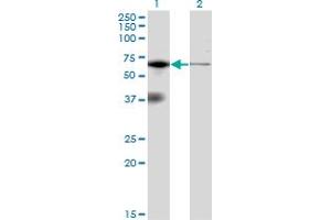 Western Blot analysis of EIF2AK2 expression in transfected 293T cell line by EIF2AK2 monoclonal antibody (M02), clone 1D11.