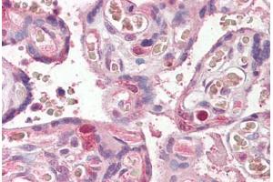 Anti-FANCE antibody IHC staining of human placenta. (FANCE antibody  (AA 235-247))