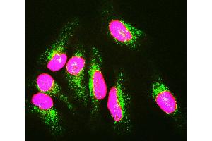 HeLa cells staining with LMNA / Lamin A/C antibody (red), and counterstained with 6E2 monoclonal antibody to Lysosomal Associated Membrane Protein 1 (Lamp1, green) and DNA (blue). (Lamin A/C antibody)