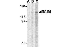 Western Blotting (WB) image for anti-TBC1 (Tre-2/USP6, BUB2, Cdc16) Domain Family, Member 1 (TBC1D1) (C-Term) antibody (ABIN1030722) (TBC1D1 antibody  (C-Term))