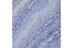 Immunohistochemistry of paraffin-embedded mouse testis using HELLS Antibody (ABIN5973444) at dilution of 1/100 (40x lens). (HELLS antibody)