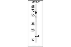 Western blot analysis of hCG_1646420 Antibody (Center) in MCF-7 cell line lysates (35ug/lane). (CLDN25 antibody  (Middle Region))