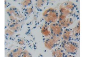 Immunohistochemistry (IHC) image for anti-GDP Dissociation Inhibitor 1 (GDI1) (AA 1-274) antibody (ABIN7440635)