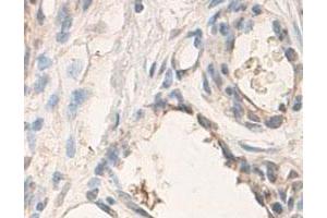 Immunohistochemical staining of formalin-fixed paraffin-embedded human skin tissue with ADAMTS3 polyclonal antibody  at 1 : 100 dilution. (ADAMTS3 antibody  (C-Term))