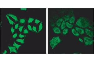Immunofluorescence (2μg/ml) staining of methanol-fixed HeLa before (left) and after (right) introduction of siRNA. (SPG20 antibody  (Internal Region))