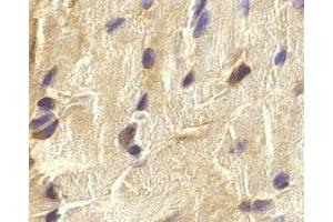 Immunohistochemistry of ECSIT in mouse heart cells with ECSIT antibody at 2 μg/ml. (ECSIT antibody  (C-Term))