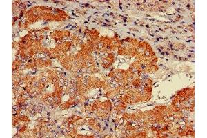 IHC image of ABIN7146261 diluted at 1:600 and staining in paraffin-embedded human adrenal gland tissue performed on a Leica BondTM system.