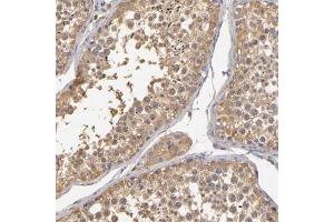 Immunohistochemical staining (Formalin-fixed paraffin-embedded sections) of human testis with GNPDA1 polyclonal antibody  shows moderate cytoplasmic positivity in germ cells at 1:200 - 1:500 dilution. (GNPDA1 antibody)