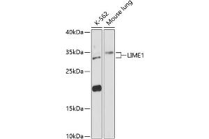 Western blot analysis of extracts of various cell lines, using LIME1 antibody (ABIN6128200, ABIN6143228, ABIN6143229 and ABIN6217817) at 1:3000 dilution. (LIME antibody  (AA 1-295))