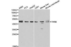 Western blot analysis of extracts of various cell lines, using THRB antibody. (THRB antibody  (AA 1-250))