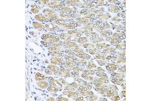 Immunohistochemistry of paraffin-embedded mouse stomach using R antibody (ABIN3021523, ABIN3021524, ABIN3021525 and ABIN6215193) at dilution of 1:100 (40x lens). (RAC2 antibody  (AA 1-192))