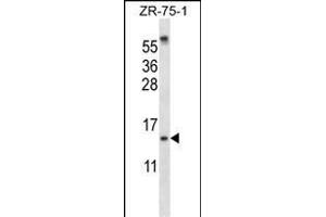 SUMO1 Antibody (N-term) (ABIN657634 and ABIN2846630) western blot analysis in ZR-75-1 cell line lysates (35 μg/lane). (SUMO1 antibody  (N-Term))