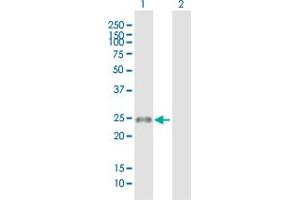 Western Blot analysis of MS4A8B expression in transfected 293T cell line by MS4A8B MaxPab polyclonal antibody.