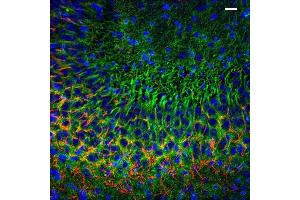 Immunolabeling of postnatal 14 mouse CA3 specifically labeling PSD93 (Cat no (ABIN1304598), 1:400, green) and Ankyrin G(red).