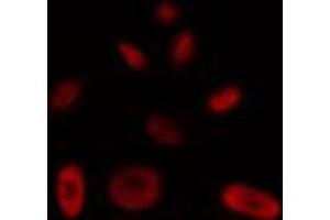 ABIN6272448 staining HT29 by IF/ICC. (Protein Tob1 (TOB1) (Internal Region) antibody)