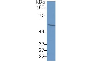 Western Blot; Sample: Human Hela cell lysate; Primary Ab: 1µg/ml Rabbit Anti-Human FSCN Antibody Second Ab: 0. (Fascin antibody  (AA 277-396))