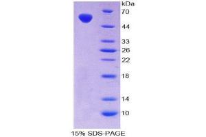 SDS-PAGE (SDS) image for V-Fos FBJ Murine Osteosarcoma Viral Oncogene Homolog (FOS) (AA 6-240) protein (His tag,GST tag) (ABIN2123736) (FOS Protein (AA 6-240) (His tag,GST tag))