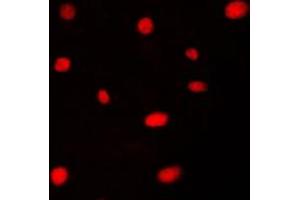 Immunofluorescent analysis of AATF staining in HeLa cells. (AATF antibody  (N-Term))