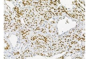 IHC analysis of Emerin using anti-Emerin antibody (ABIN4886569). (Emerin antibody  (N-Term))