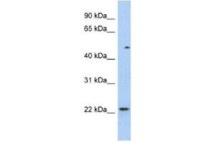 TCEAL3 antibody used at 0. (TCEAL3 antibody  (N-Term))