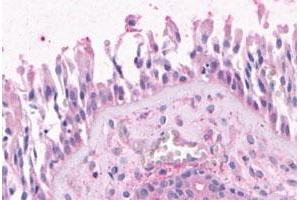 Immunohistochemical (Formalin/PFA-fixed paraffin-embedded sections) staining in human nasal mucosa, respiratory epithelium with OR2A4 polyclonal antibody . (OR2A4 antibody  (3rd Cytoplasmic Domain))