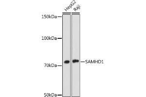 Western blot analysis of extracts of various cell lines, using S antibody (ABIN7270142) at 1:1000 dilution. (SAMHD1 antibody)