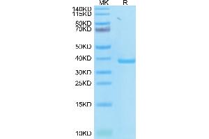 SARS-CoV-2 PLpro on Tris-Bis PAGE under reduced condition. (SARS-CoV NSP3 Protein (AA 1-314) (His-Avi Tag))