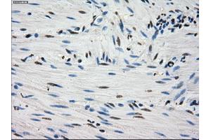Immunohistochemical staining of paraffin-embedded Kidney tissue using anti-FHmouse monoclonal antibody. (FH antibody)