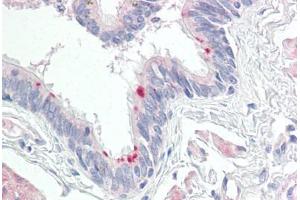 Image no. 2 for anti-Mitochondrial Ribosomal Protein L24 (MRPL24) (AA 101-150) antibody (ABIN2879173) (MRPL24 antibody  (AA 101-150))