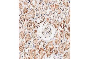 Immunohistochemical analysis of E on paraffin-embedded human kidney tissue was performed on the Leica®BOND RXm.