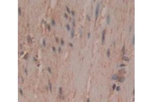 Figure. (CLMP antibody  (AA 19-183))