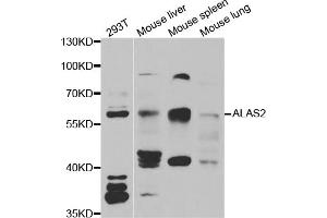 Western blot analysis of extracts of various cell lines, using ALAS2 antibody (ABIN5973907) at 1/1000 dilution.