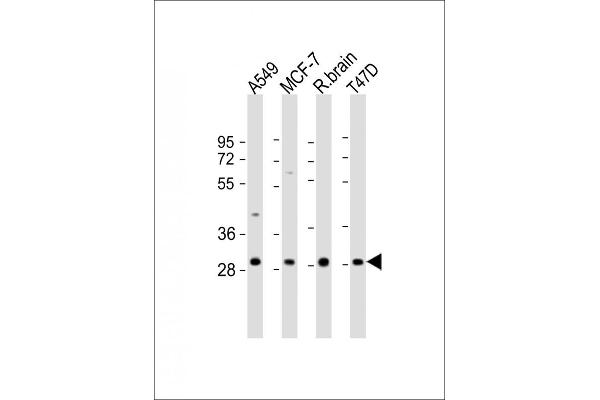 ACBD4 抗体  (AA 103-136)