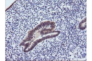 Image no. 1 for anti-Phosphoinositide-3-Kinase, Regulatory Subunit 5 (PIK3R5) antibody (ABIN1500212) (PIK3R5 antibody)