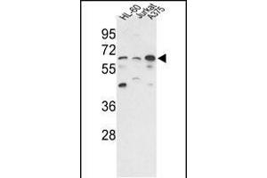 Western blot analysis of hP3CC-E33 (ABIN392895 and ABIN2837849) in HL-60, Jurkat,  cell line lysates (35 μg/lane). (PPP3CC antibody  (N-Term))