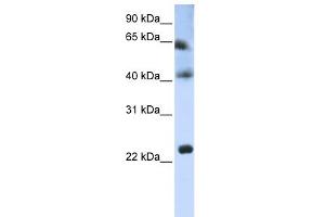 WB Suggested Anti-TSPAN3 Antibody Titration:  0. (Tetraspanin 3 antibody  (Middle Region))