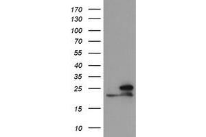 Image no. 1 for anti-NADH Dehydrogenase (Ubiquinone) 1 beta Subcomplex, 10, 22kDa (NDUFB10) antibody (ABIN1499670) (NDUFB10 antibody)