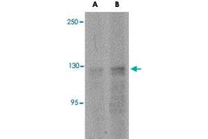 Western blot analysis of ANO2 in rat brain tissue lysate with ANO2 polyclonal antibody  at (A) 1 and (B) 2 ug/mL .