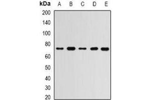 Western blot analysis of RBBP5 expression in MCF7 (A), Hela (B), mouse spleen (C), mouse brain (D), rat liver (E) whole cell lysates.