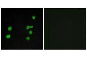 Immunofluorescence analysis of MCF-7 cells, using p97 MAPK antibody. (MAPK6 antibody)